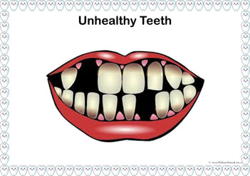 Teeth Cut Paste2, healthy teeth activity