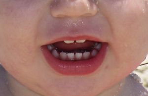 How To Brush Baby&#039;s Teeth