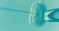 IVF Children